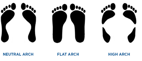 arch types foot