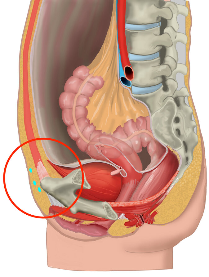 sagittal section female pelvis with veins